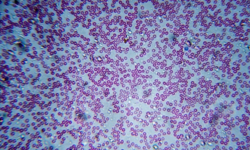 red and white blood cells under a microscope